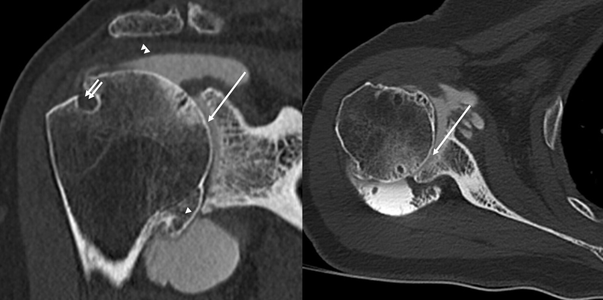 Arthroscanner examen